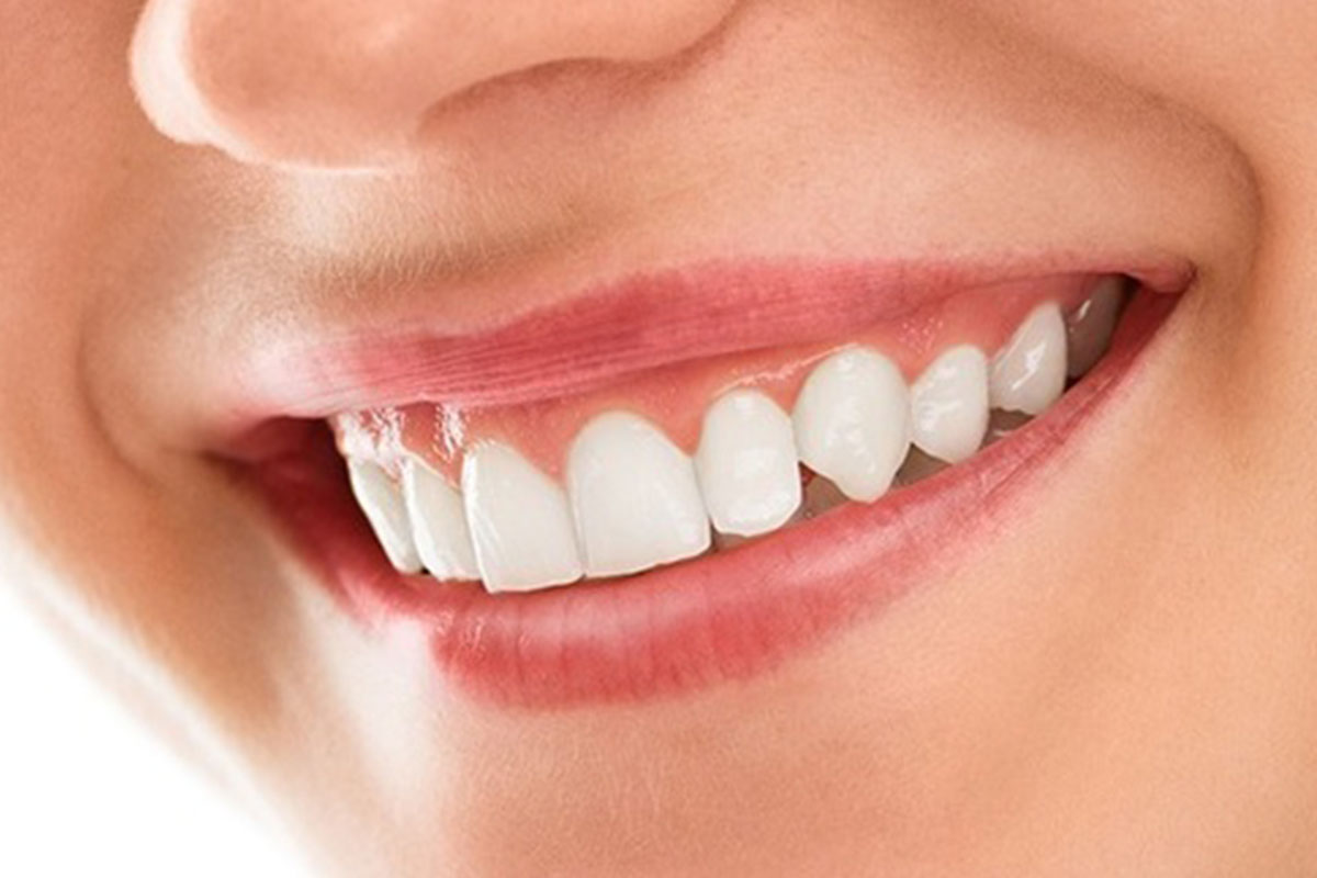 Smile